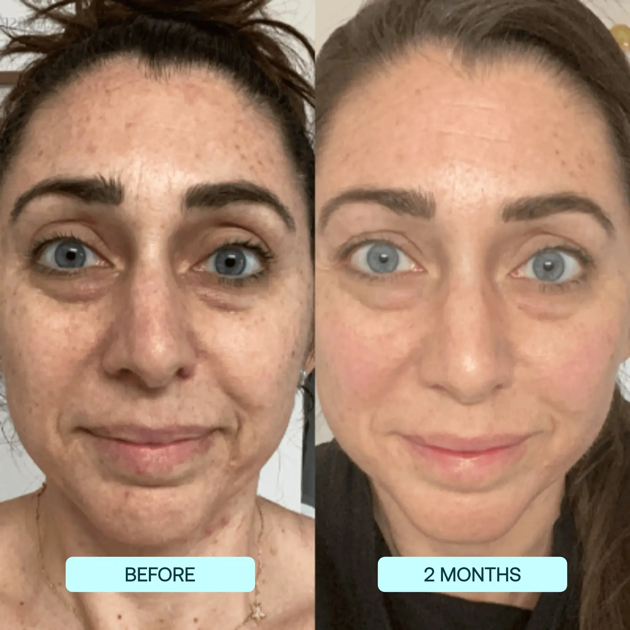 MELTING COLLAGEN STRIPS