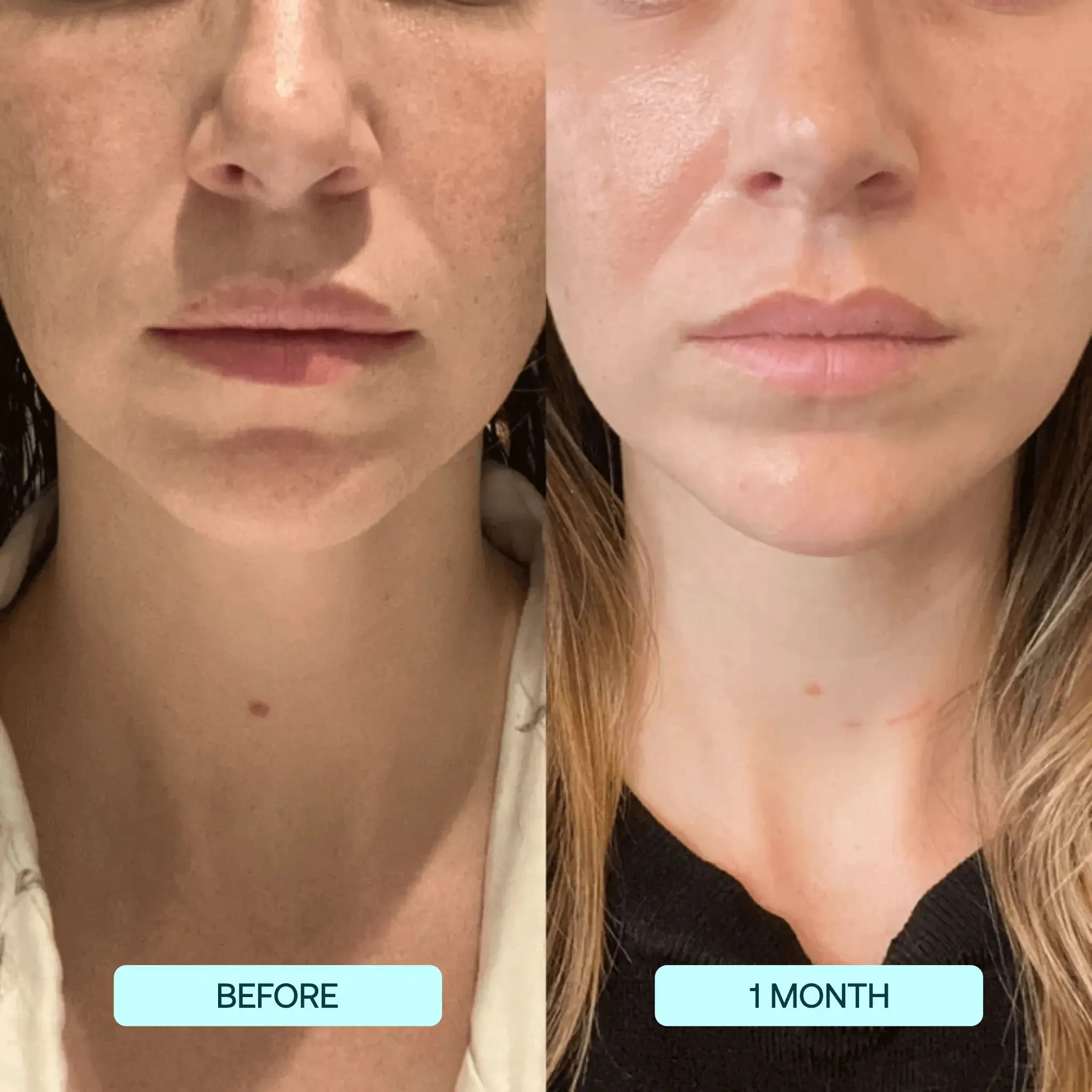 MELTING COLLAGEN STRIPS